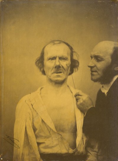 البكاء ، دموع الشفقة على اليسار ، الوجه المسترخى الأيمن ، 1854-1856 ، مطبوع عام 1862. بواسطة دوشين دي بولوني