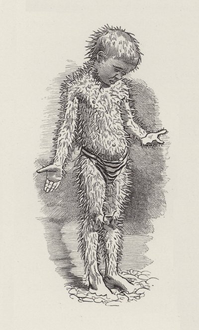 رسم توضيحي للأطفال الصغار بواسطة تشارلز كينجسلي (نقش) بواسطة إدوارد لينلي (بعد) سامبورن