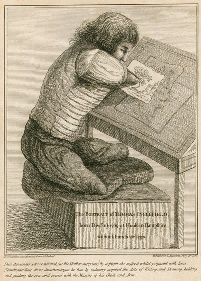 توماس إنجلفيلد ، ولد في 18 ديسمبر 1769 في هوك ، هامبشاير ، بدون أسلحة أو أرجل بواسطة مدرسة اللغة الإنجليزية
