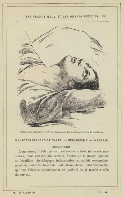 الموقف الهستيري أثناء فترة الوصول التحفيزي وأثناء مرحلة الصلب (لون الحجر الصخري) بواسطة المدرسة الفرنسية