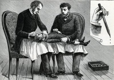 أطباء يفحصون عيون طفل ويحقنون قطرة للعين (نقش) 1888 بواسطة المدرسة الفرنسية
