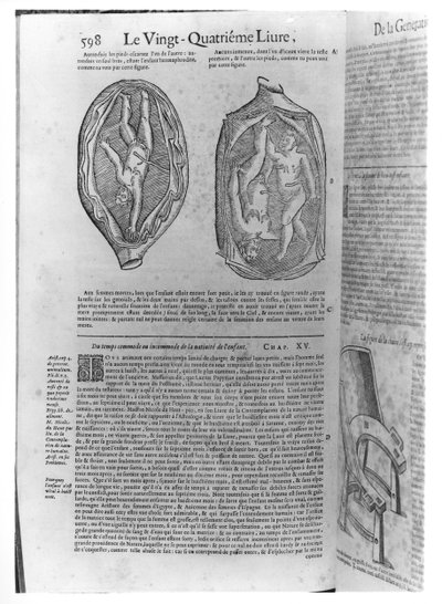 جنين ، رسم توضيحي من Oeuvres بواسطة Ambroise Pare (1509-90) نشر في ليون ، 1641 بواسطة المدرسة الفرنسية