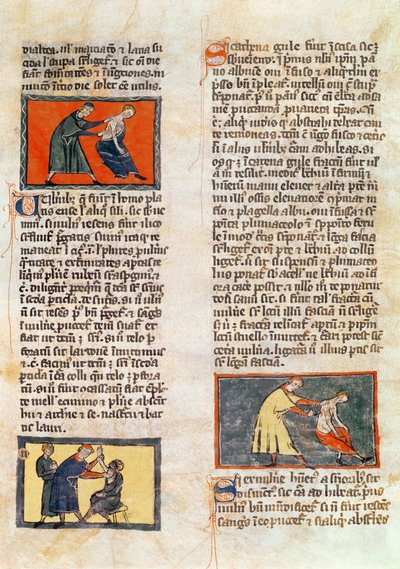السيدة H 89 fol.17r الجراحة ، من طبعة من "كتاب الجراحة" بقلم روجير دي ساليرن بواسطة المدرسة الفرنسية