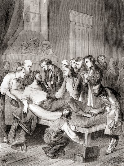 أول عرض عام لاستخدام الأثير المستنشق كمخدر جراحي في عام 1846 من قبل طبيب الأسنان الأمريكي ، ويليام توماس جرين مورتون ، من "Les Merveilles de la Science" ، نُشر عام 1870 بواسطة المدرسة الفرنسية