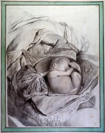 تمثيل لجنين إنسان في الرحم نقش بقلم جيرارد دي لايرس (1640-1711) يوضح "Anatomia Humani Corporis" لجوفرت بيدلو (أو جوفارد) (1649-1713) مكتبة القرن الثامن عشر لكلية الطب ، باريس بواسطة جيرارد دي لايرس