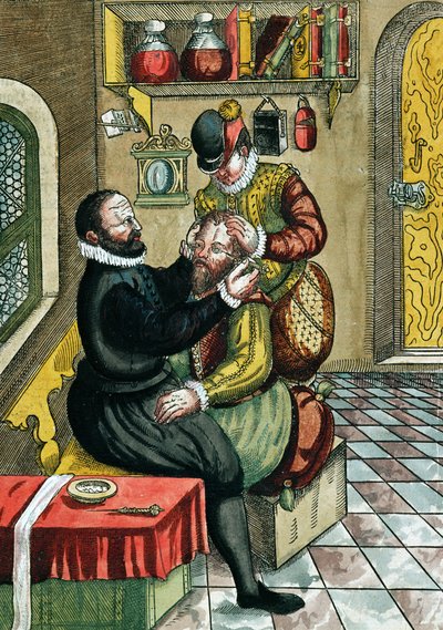 عملية إعتام عدسة العين ، من Ophthalmodouleia بواسطة جورج بارتيش (1535-1636) المنشورة في دريسدن في 1583 (طبعة خشبية ملونة) بواسطة المدرسة الألمانية