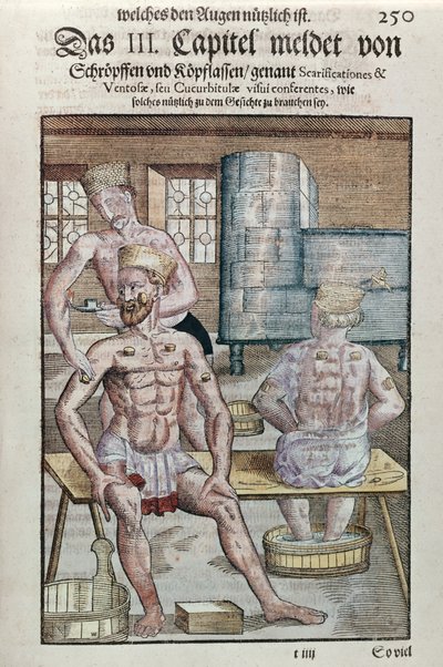 الحجامة ، من Ophthalmodouleia بواسطة جورج بارتيش (1535-1636) المنشورة في دريسدن في 1583 (طباعة لوحة خشبية ملونة) بواسطة المدرسة الألمانية