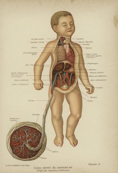 رسم تخطيطي يُظهر الأعضاء الداخلية لطفل حديث الولادة وحبله السري (حجر ملون) بواسطة المدرسة الألمانية