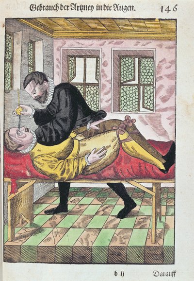 عملية العين ، من Ophthalmodouleia بواسطة جورج بارتيش (1535-1636) المنشورة في دريسدن في 1583 (طباعة لوحة خشبية ملونة) بواسطة المدرسة الألمانية