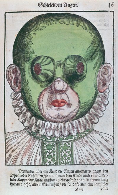 قناع لعلاج الحول ، من Ophthalmodouleia بواسطة جورج بارتيش (1535-1636) نشر في دريسدن عام 1583 (طباعة لوح خشبي ملون) بواسطة المدرسة الألمانية