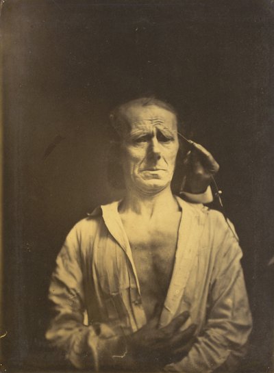 تشنج م. المموج supercilii تحت ضوء قوي جدًا (يسار) ؛ وجه مسترخي (تم تصويره بأشعة الشمس الساطعة) (يمين) بواسطة Guillaume Benjamin Amant Duchenne
