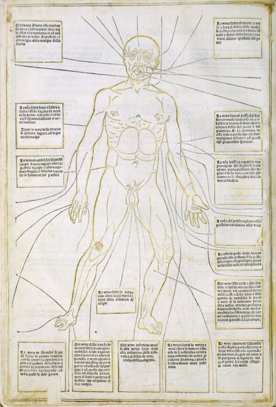 رسم توضيحي من "Fassiculus Medicinae" البندقية بواسطة المدرسة الايطالية
