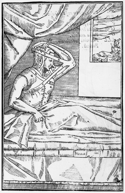 جراحة ترميمية على الأنف ، رسم توضيحي من De curtorum chirurgia per insitionem بواسطة Gaspare Tagliacozzi (1545-99) البندقية ، تم نشره عام 1597 بواسطة المدرسة الايطالية