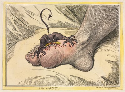 النقرس ، 1799. بواسطة جيمس جيلراي
