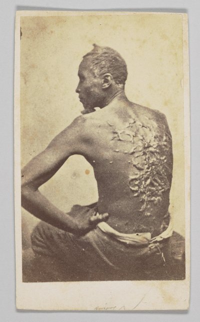 جوردون تحت الفحص الطبي ، 1863. بواسطة ماكفرسون وأوليفر