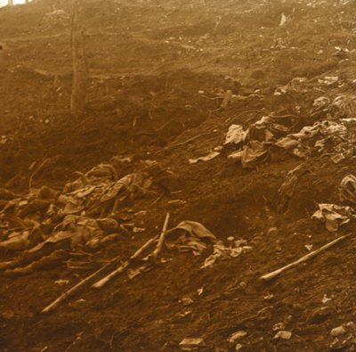 بعد الهجوم ، Les Éparges ، شمال فرنسا ، 1915. بواسطة غير معروف