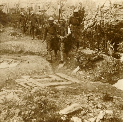 جنود مشاة فرنسيون مصابون يصلون إلى شاتو دينيس ، فردان ، شمال فرنسا ، 1916 بواسطة غير معروف