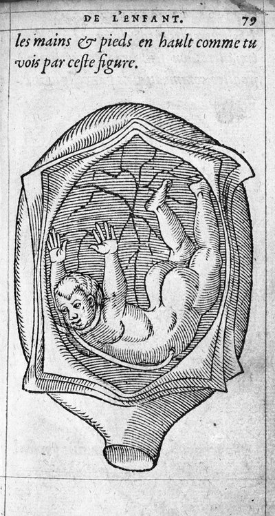مكانة الجنين في الرحم أثناء الحمل. نقش من "De la generation des enfants" للطبيب والجراح الفرنسي Ambroise Pare (1509-1590) من القرن السادس عشر بواسطة فنان غير معروف