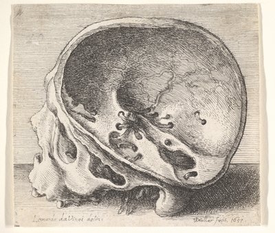 جمجمة مجزأة في شكل جانبي إلى اليسار مع إزالة الجانب الأيسر من الجمجمة ، 1651. بواسطة وينسلوس هولار