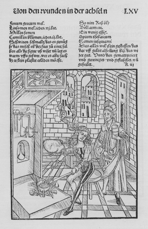 The Book of Cirurgia by Hieronymus Brunschwig (litho) بواسطة (بعد) المدرسة الألمانية