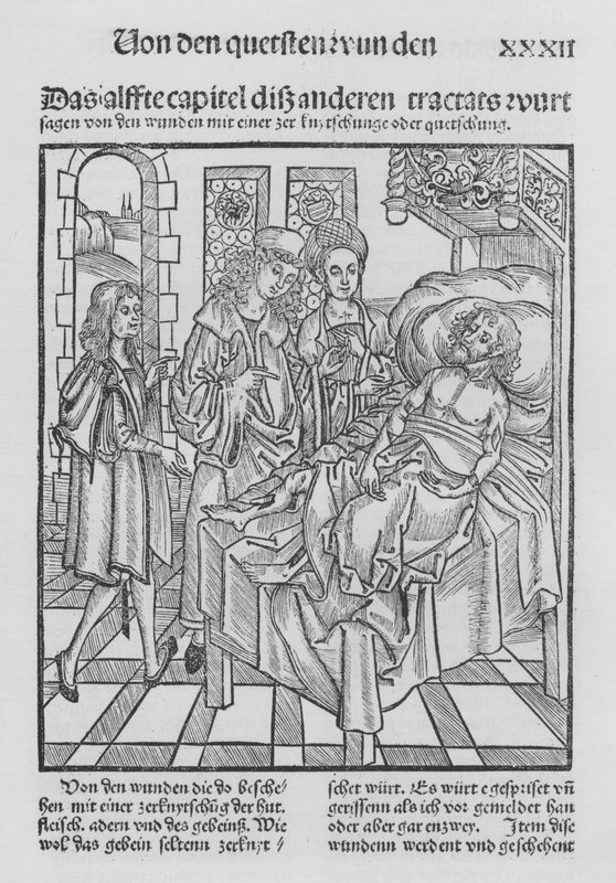The Book of Cirurgia by Hieronymus Brunschwig (litho) بواسطة (بعد) المدرسة الألمانية