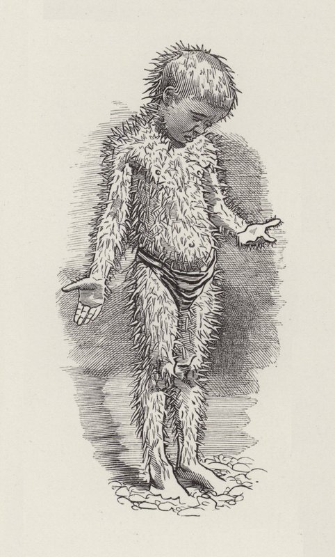 رسم توضيحي للأطفال الصغار بواسطة تشارلز كينجسلي (نقش) بواسطة إدوارد لينلي (بعد) سامبورن