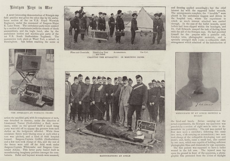 Rontgen Rays in War بواسطة مصور انجليزى