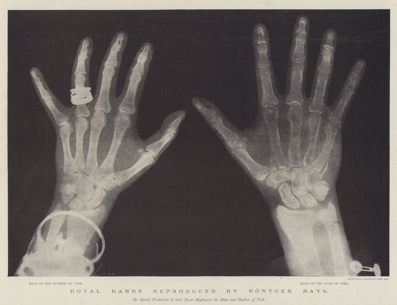 Royal Hands reproduced by Rontgen Rays (engraving) بواسطة مدرسة اللغة الإنجليزية