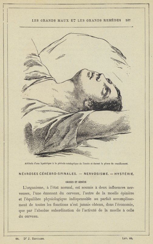 الموقف الهستيري أثناء فترة الوصول التحفيزي وأثناء مرحلة الصلب (لون الحجر الصخري) بواسطة المدرسة الفرنسية