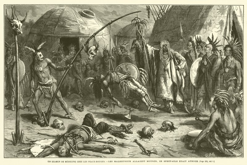 امتحان طب Redskin (نقش) بواسطة المدرسة الفرنسية